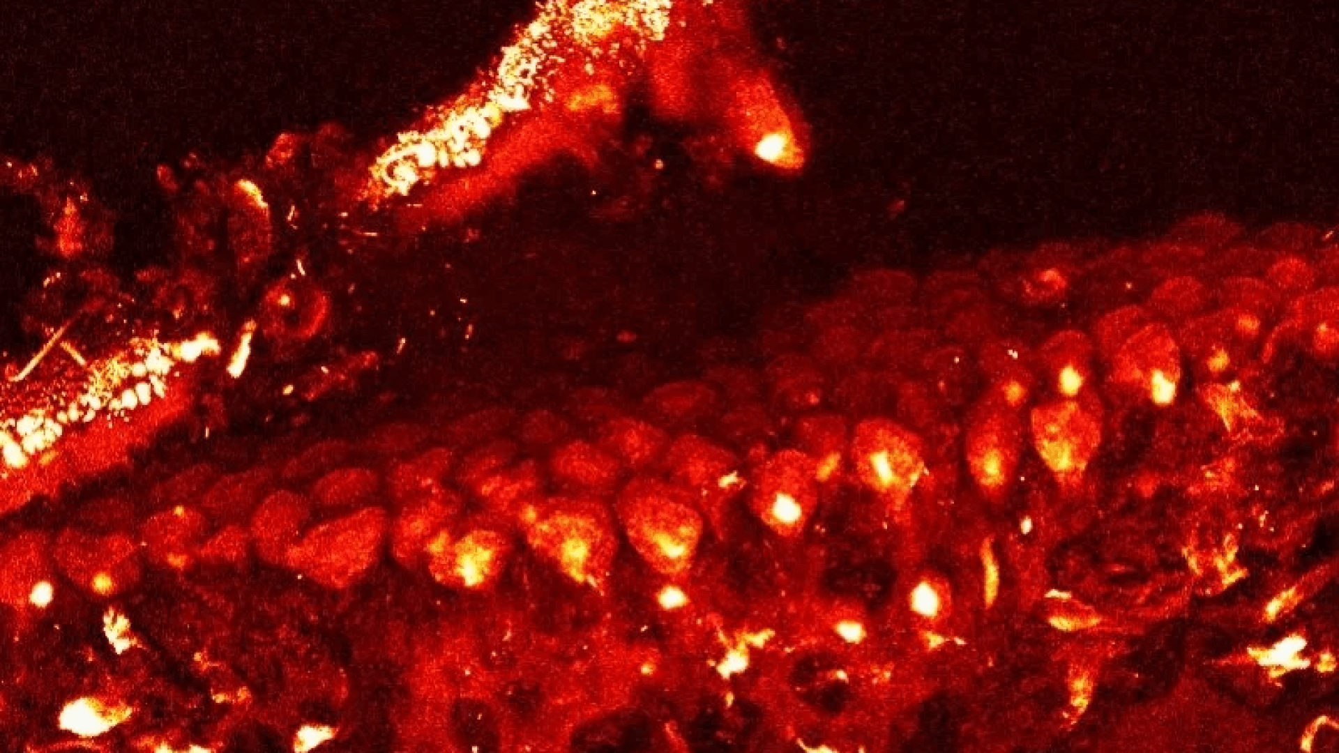 Confocal microscope image of Ascophyllum Shedding