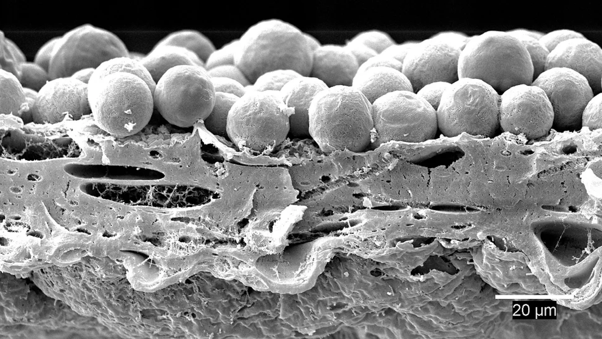 SEM microscope image of Salamander Algae Capsule Wall