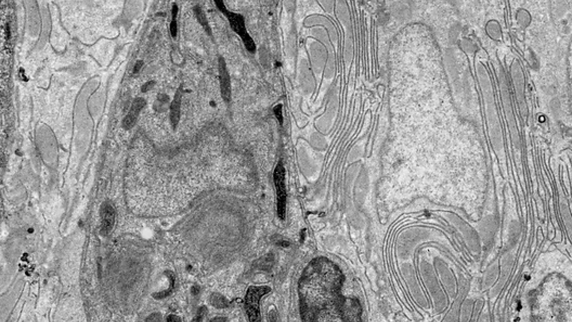 TEM microscope image of Killifish Columnar Epithelium