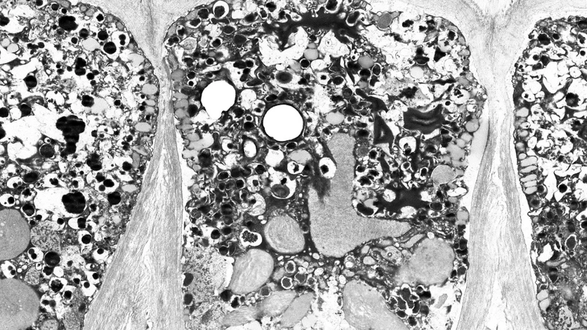 TEM microscope image of Plant Epiphilial Cell
